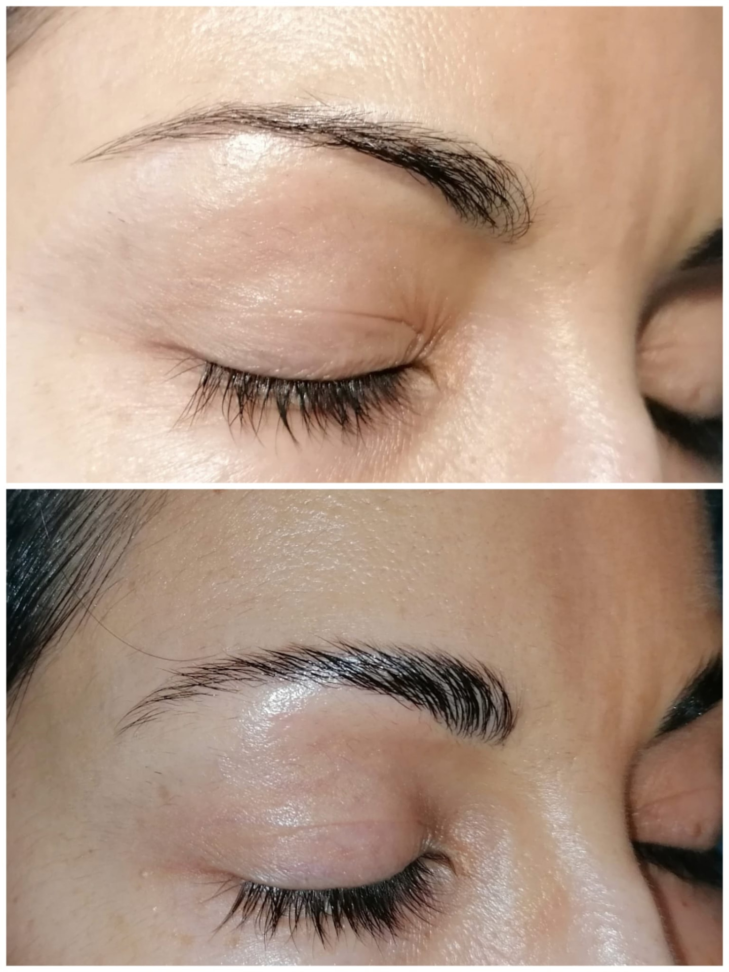 Antes e depois de tratamento de sobrancelhas