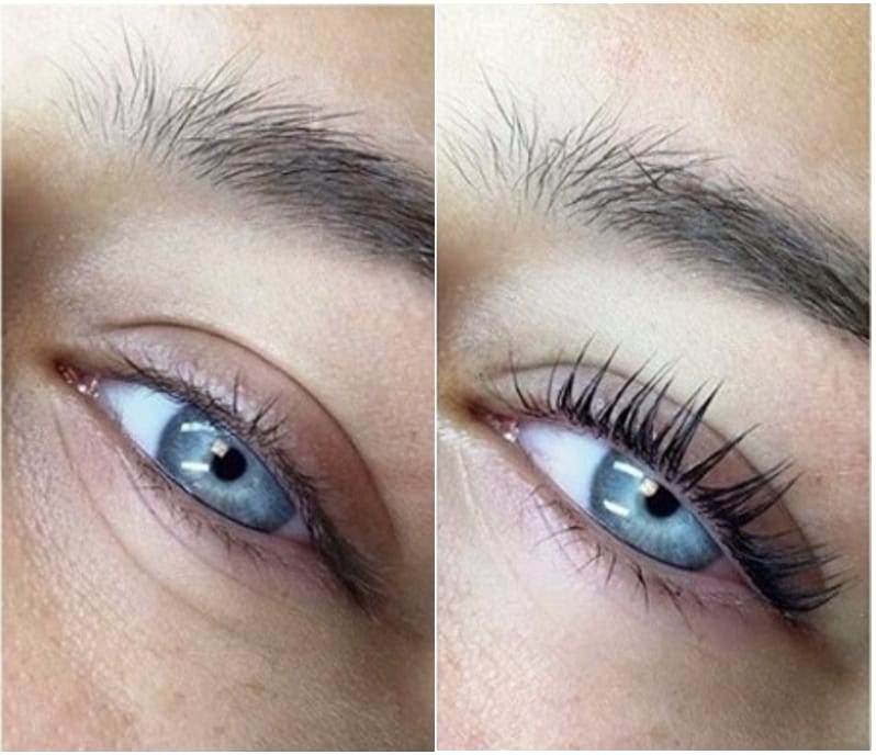 Antes e depois de lifting de pestanas